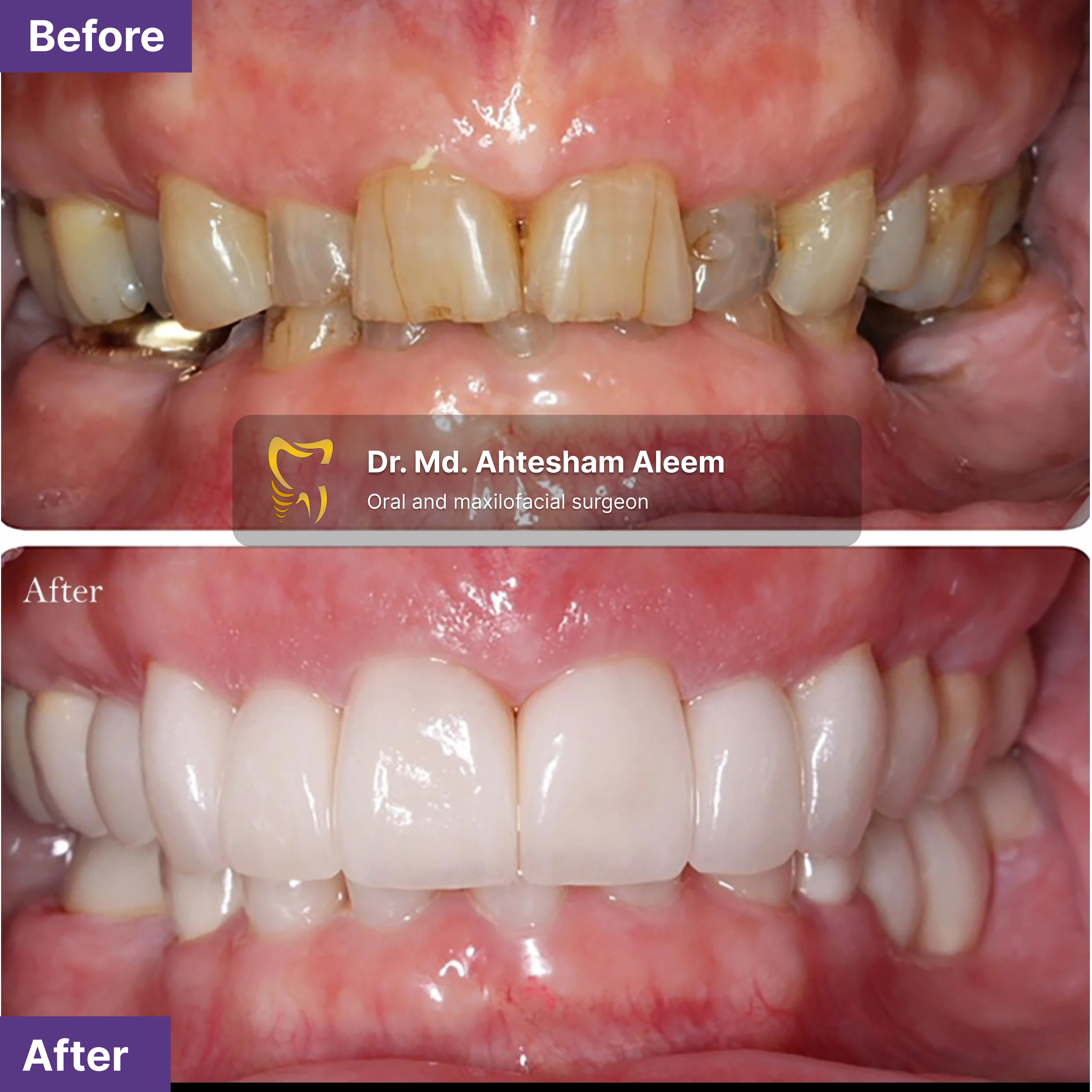 Smile Designing Image 1